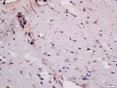 MDGA2 Rabbit Polyclonal Antibody