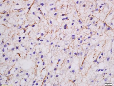 MDGA2 Rabbit Polyclonal Antibody