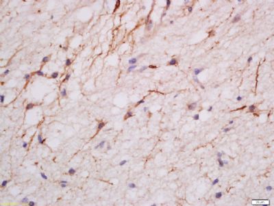 MDGA2 Rabbit Polyclonal Antibody