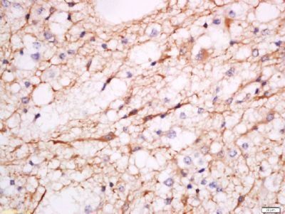 MDGA2 Rabbit Polyclonal Antibody
