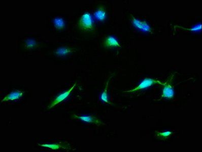 MDH1 antibody