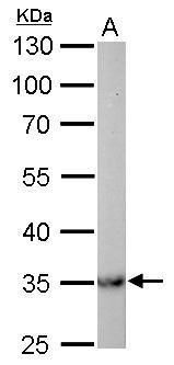 malate dehydrogenase 2 Antibody