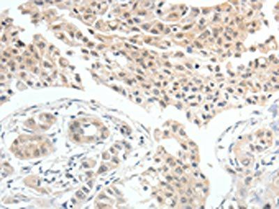 MDK Antibody