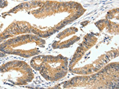 MDK Antibody