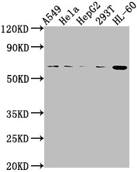 MDM2 Antibody