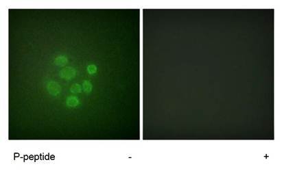 MDM2 (Phospho-Ser166) Antibody
