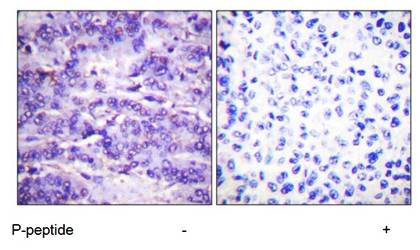 MDM2 (Phospho-Ser166) Antibody