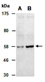 MDM2 (M) Antibody, Rabbit Polyclonal