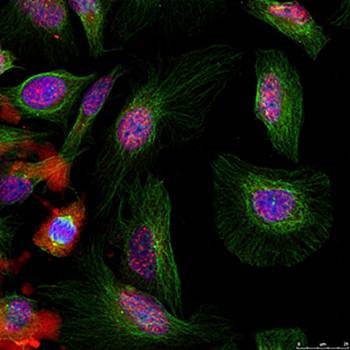 MDM2 (phospho-Ser166) Antibody