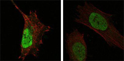 MDM4 Antibody