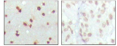 MDM4 Antibody