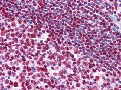MDM4 Antibody
