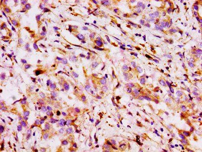 ABCB1 Antibody