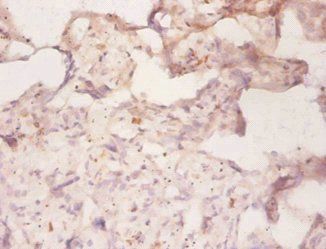 ABCB1 Antibody
