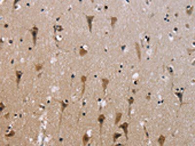 ABCB1 Antibody