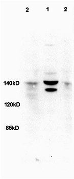 MDR1 antibody