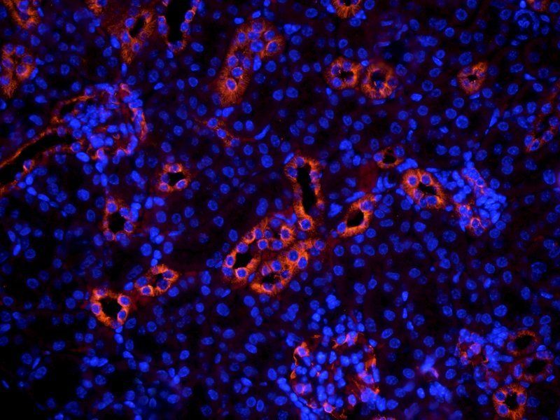 MDR1 antibody