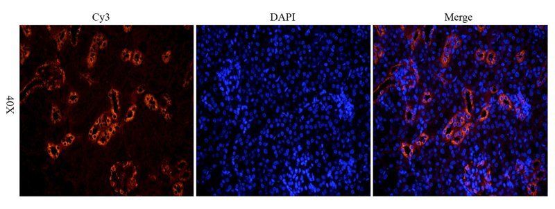 MDR1 antibody