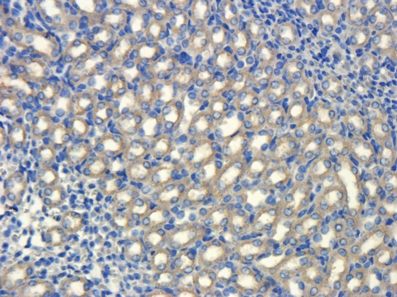 MDR1 antibody