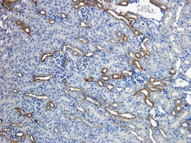 MDR1 antibody