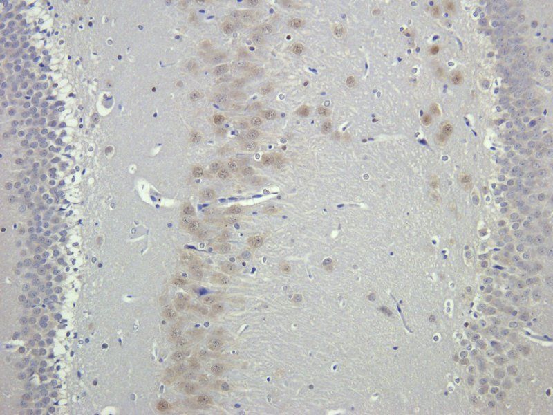 MDR1 antibody