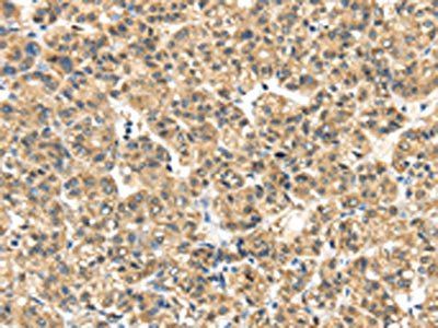 ME1 Antibody