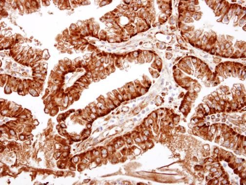 ME1 antibody
