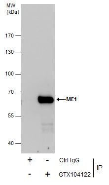 malic enzyme 1 Antibody