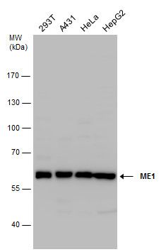 malic enzyme 1 Antibody