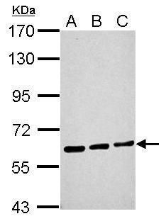 malic enzyme 1 Antibody