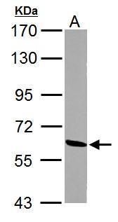 malic enzyme 1 Antibody