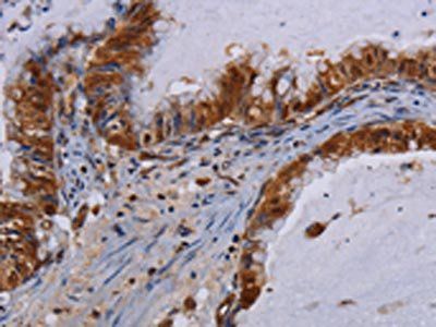MECP2 Antibody