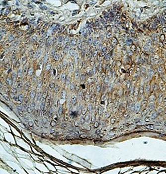 MECP2 Rabbit Polyclonal Antibody