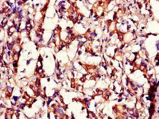 MED12 Antibody