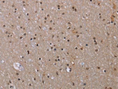 MED12 Antibody