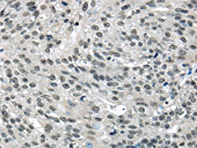 MED15 Antibody
