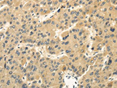 MED16 Antibody