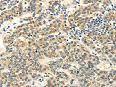 MED16 Antibody