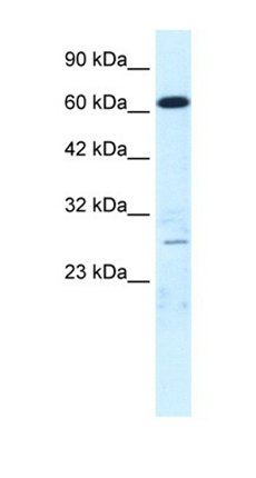 MED17 antibody