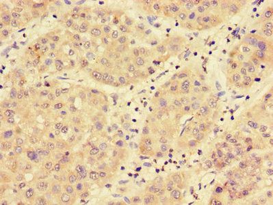 MED17 Antibody
