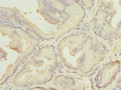 MED18 Antibody