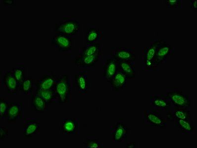 MED22 Antibody