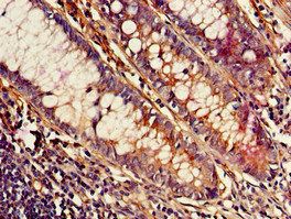 MED23 Antibody