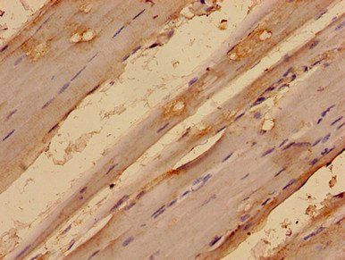 MED24 Antibody