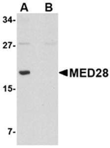 MED28 Rabbit Polyclonal Antibody