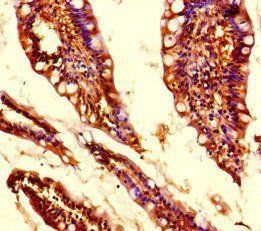 MED31 antibody