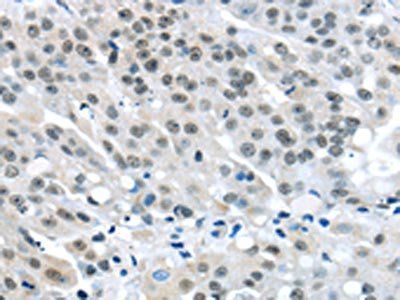 MED4 Antibody