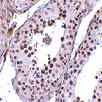 MED4 Rabbit Polyclonal Antibody