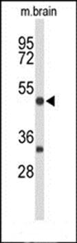 MEF2A antibody