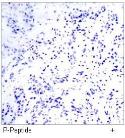 MEF2A (Phospho-Thr312) Antibody